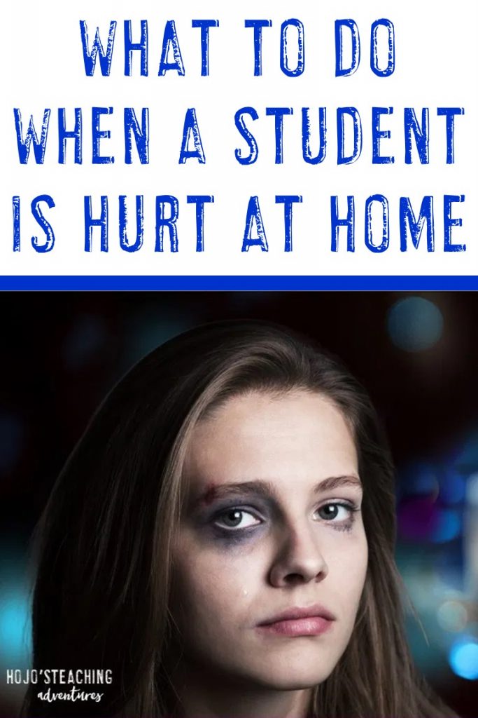 student who was hurt at home